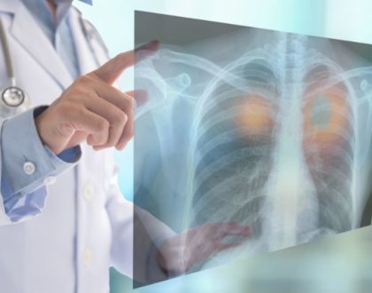 Câncer de pulmão provoca mais de 28 mil mortes no Brasil por ano